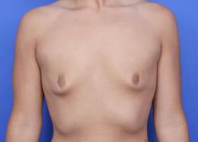 Patient Before & After Image