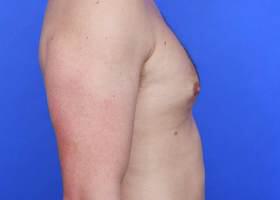 Patient Before & After Image