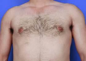 Patient Before & After Image