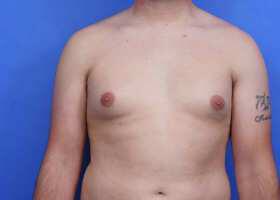 Patient Before & After Image