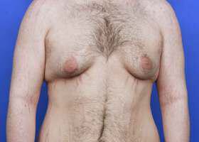 Patient Before & After Image