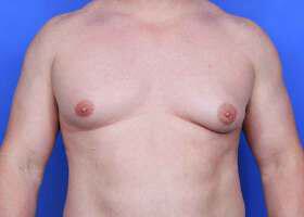 Patient Before & After Image