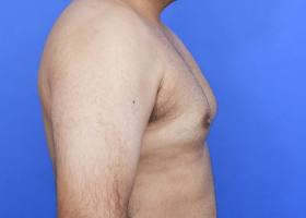 Patient Before & After Image