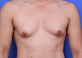 Patient Before & After Image