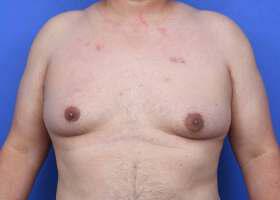 Patient Before & After Image