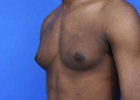 Patient Before & After Image