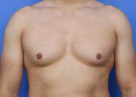 Patient Before & After Image