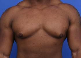 Patient Before & After Image