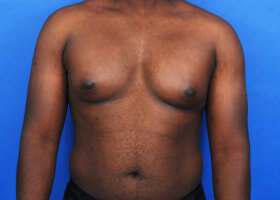 Patient Before & After Image