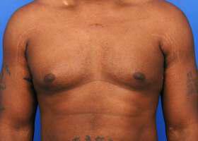 Patient Before & After Image