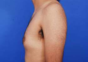 Patient Before & After Image