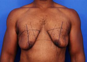 Patient Before & After Image