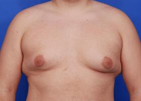 Patient Before & After Image