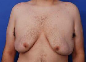 Patient Before & After Image