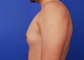 Patient Before & After Image