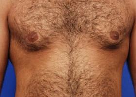 Patient Before & After Image