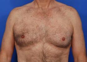 Patient Before & After Image