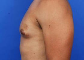 Patient Before & After Image