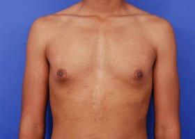 Patient Before & After Image