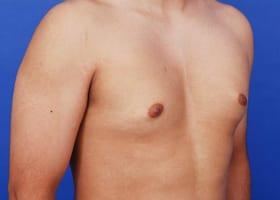 Patient Before & After Image