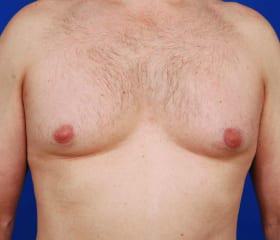 Patient Before & After Image