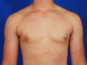 Patient Before & After Image