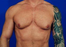 Patient Before & After Image