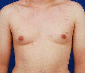 Patient Before & After Image