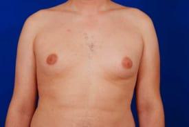 Patient Before & After Image