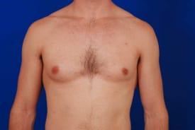 Patient Before & After Image