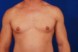 Patient Before & After Image