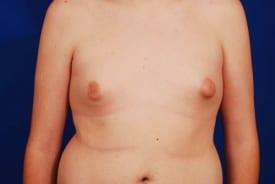 Patient Before & After Image