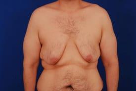 Patient Before & After Image