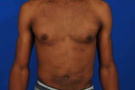 Patient Before & After Image