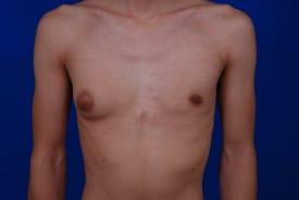 Patient Before & After Image