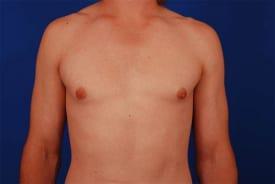 Patient Before & After Image