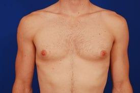 Patient Before & After Image