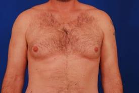 Patient Before & After Image