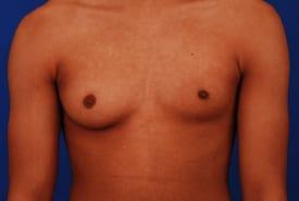 Patient Before & After Image