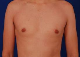 Patient Before & After Image