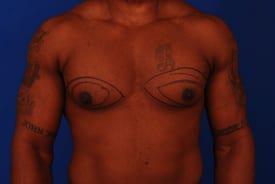 Patient Before & After Image