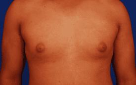 Patient Before & After Image