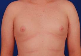 Patient Before & After Image