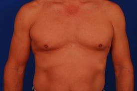 Patient Before & After Image