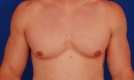 Patient Before & After Image