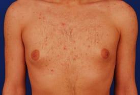 Patient Before & After Image