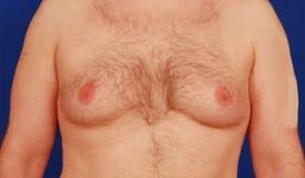 Patient Before & After Image