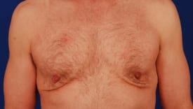 Patient Before & After Image