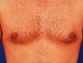 Patient Before & After Image