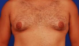 Patient Before & After Image